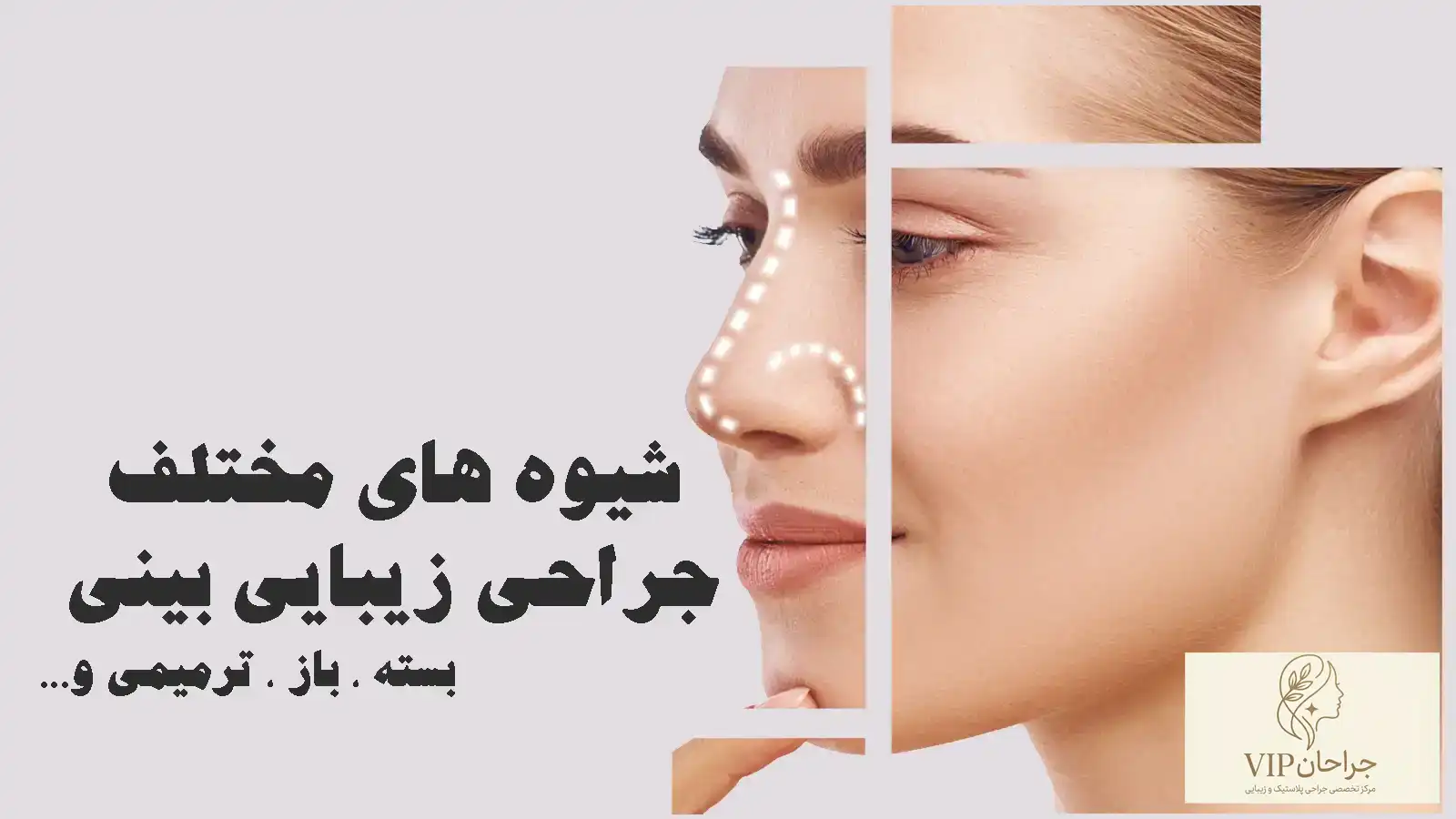 شیوه های مختلف جراحی زیبایی بینی (رینوپلاستی) | روش‌ها و تکنیک‌های مدرن